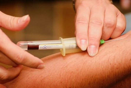 Senkung des Blutdrucks mit Hilfe der Akupunktur